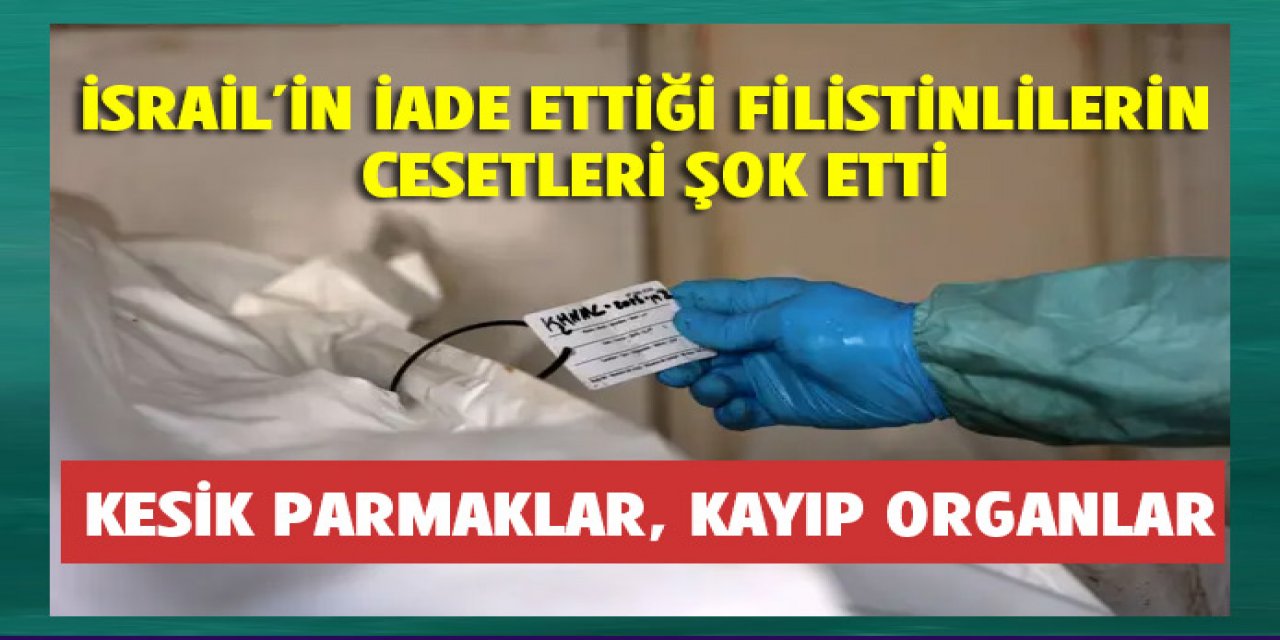 İsrail'in iade ettiği Filistinli cenazeler şok etti