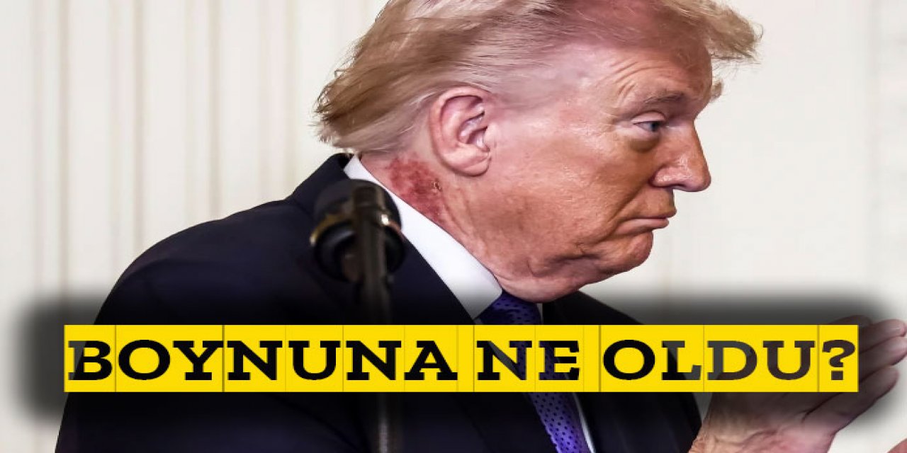 Trump'ın boynunda gizemli döküntü